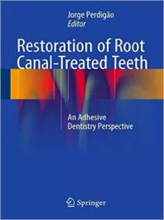 Restoration of Root Canal-Treated Teeth