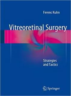 Vitreoretinal Surgery: Strategies and Tactics