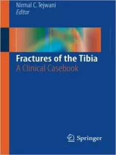 Fractures of the Tibia: A Clinical Casebook