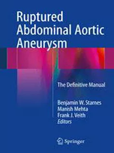 Ruptured Abdominal Aortic Aneurysm: The Definitive Manual