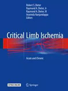 9783319319896 Critical Limb Ischemia: Acute and Chronic