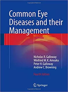 9783319328676 Common Eye Diseases and Their Management