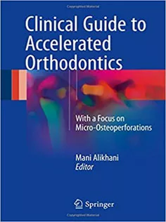 Clinical Guide to Accelerated Orthodontics