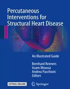 Percutaneous Interventions for Structural Heart Disease: An Illustrated Guide