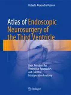 9783319500676 Atlas of Endoscopic Neurosurgery of the Third Ventricle