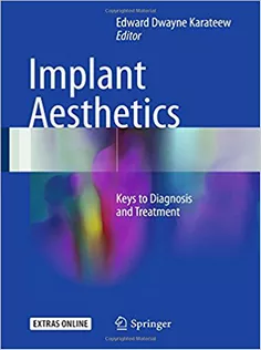 Implant Aesthetics: Keys to Diagnosis and Treatment