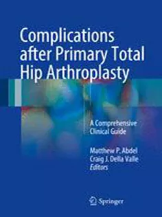 9783319549118 Complications After Primary Total Hip Arthroplasty