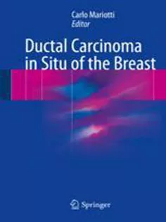 9783319574509 Ductal Carcinoma in Situ of the Breast