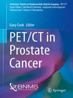 PET/CT in Prostate Cancer (Clinicians’ Guides to Radionuclide Hybrid Imaging)