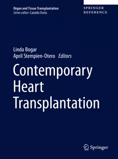 Contemporary Heart Transplantation