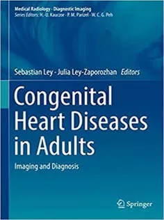9783319618869 Congenital Heart Diseases in Adults: Imaging and Diagnosis