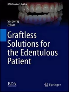 Graftless Solutions for the Edentulous Patient