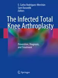 9783319667294 The Infected Total Knee Arthroplasty: Prevention, Diagnosis, and Treatment