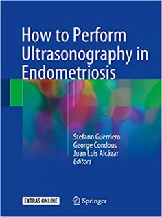 How to Perform Ultrasonography in Endometriosis