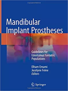 Mandibular Implant Prostheses: Guidelines for Edentulous Geriatric Populations