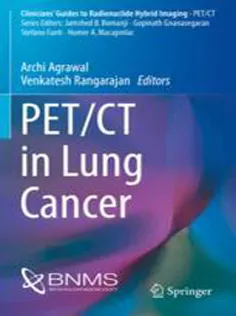 9783319726601 PET/CT in Lung Cancer