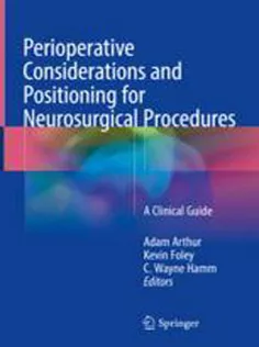 9783319726786 Perioperative Considerations and Positioning for Neurosurgical Procedures