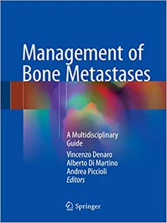 Management of Bone Metastases: A Multidisciplinary Guide