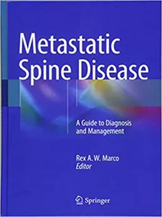 Metastatic Spine Disease A Guide to Diagnosis and Management