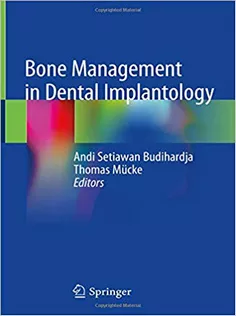 Bone Management in Dental Implantology