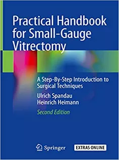 Practical Handbook for Small-Gauge Vitrectomy