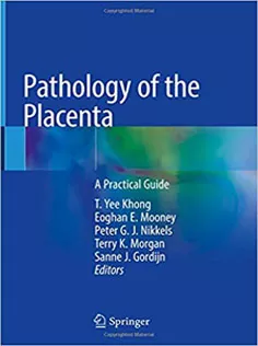 Pathology of the Placenta: A Practical Guide