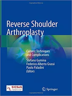 9783319977423 Reverse Shoulder Arthroplasty: Current Techniques and Complications