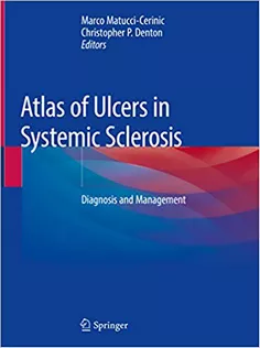9783319984759 Atlas of Ulcers in Systemic Sclerosis: Diagnosis and Management