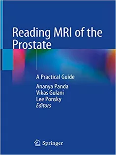 Reading MRI of the Prostate: A Practical Guide