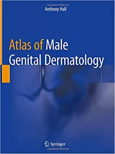Atlas of Male Genital Dermatology