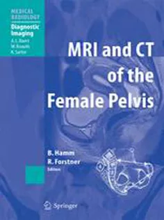 MRI and CT of the Female Pelvis-Medical Radiology