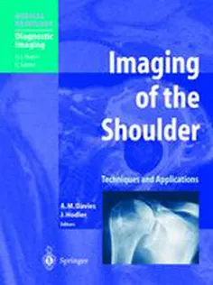 Imaging of the Shoulder: Techniques and Applications