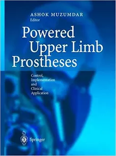 Powered Upper Limb Prostheses: Control, Implementation and Clinical Application