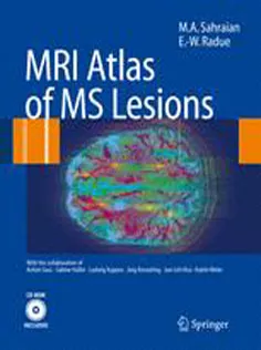 MRI Atlas of MS Lesions