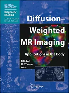 Diffusion-Weighted MR Imaging of the Brain