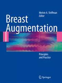 Breast Augmentation: Principles and Practice