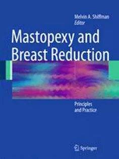 Mastopexy & Breast Reduction