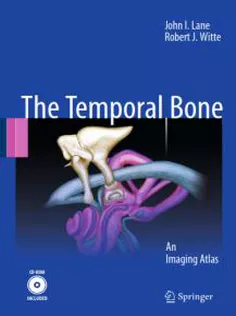 Temporal Bone: An Imaging Atlas