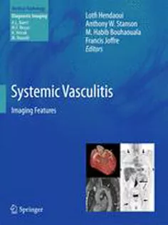 Systemic Vasculitis :Imaging Features