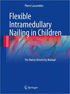 Flexible Intramedullary Nailing in Children