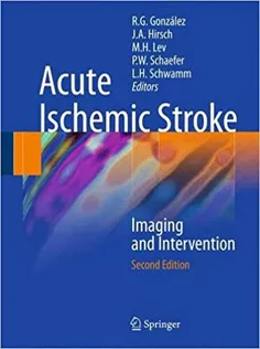 Acute Ischemic Stroke: Imaging and Intervention