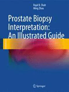 Prostate Biopsy Interpretation : An Illustrated Guide