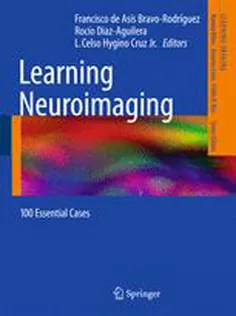 Learning Neuroimaging :100 Essential Cases
