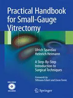 Practical Handbook for Small-Gauge Vitrectomy 2012