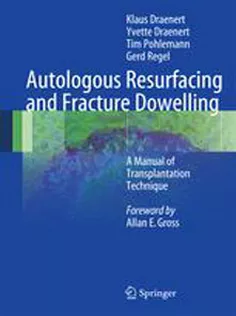 9783642249105 Autologous Resurfacing and Fracture Dowelling: A Manual of Transplantation Technique