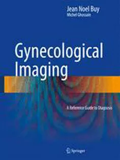 Gynecological Imaging: A Reference Guide to Diagnosis