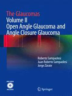 The Glaucomas Volume II Open Angle Glaucoma & Angle Closure Glaucoma