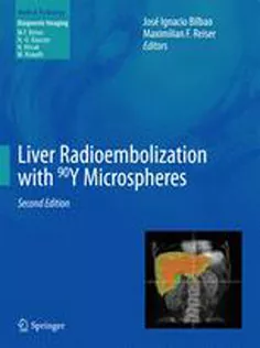 9783642364723 Liver Radioembolization with 90Y Microspheres