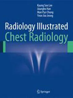 9783642370953 Radiology Illustrated Chest Radiology