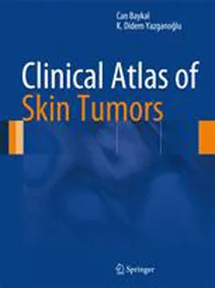 9783642409370 Clinical Atlas of Skin Tumors